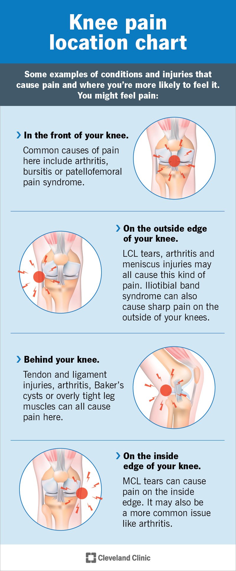 Some examples of where you feel knee pain and what may be causing it